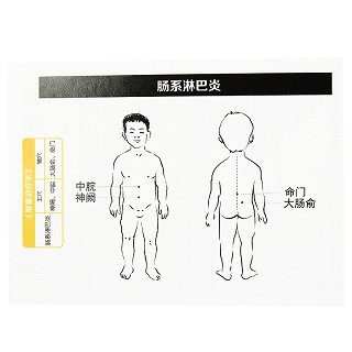 琼森 穴位贴敷治疗贴（肠系淋巴炎） 50mm*50mm*8贴