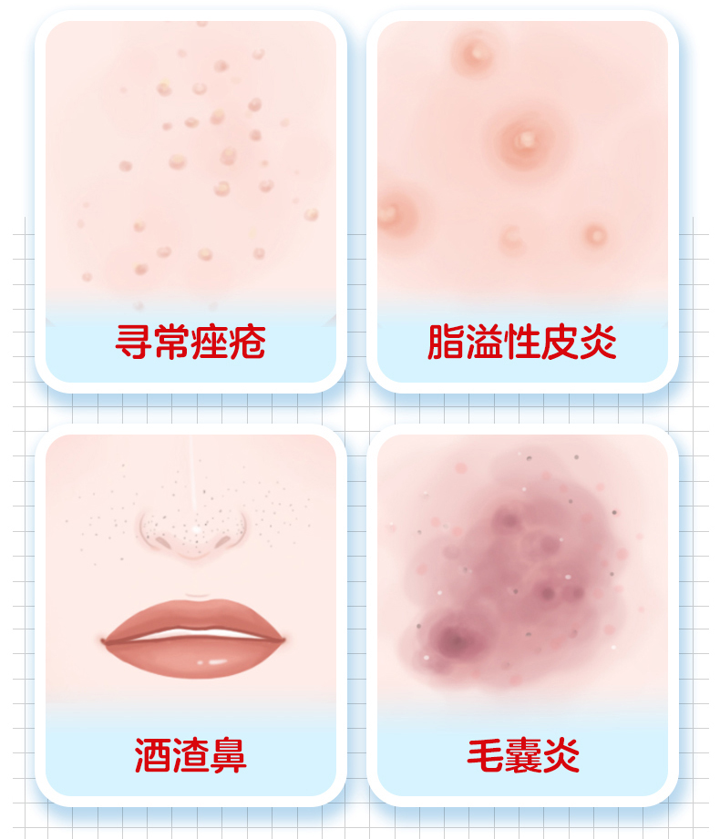 座康王 克林霉素甲硝唑搽剂 40ml